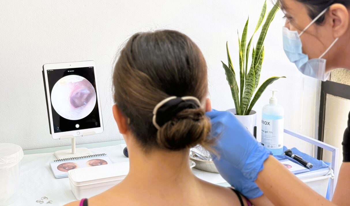 ¿Por qué NO usar cotonitos ni métodos caseros para limpiar tus oídos?