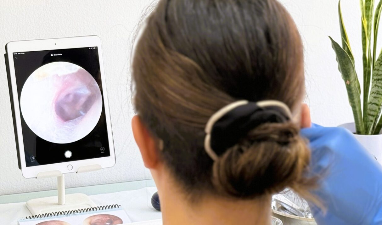 Video otoscopia: la cámara que muestra la salud de tus oídos